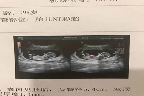 nt怎么看男女【nt视角下的男女对比分析】